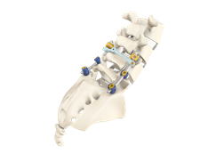 Sistema de espalda baja | Orthic